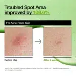 Azelaic Acid 10 Hyaluron Redness Soothing Serum – Sérum anti-imperfections – Image 5